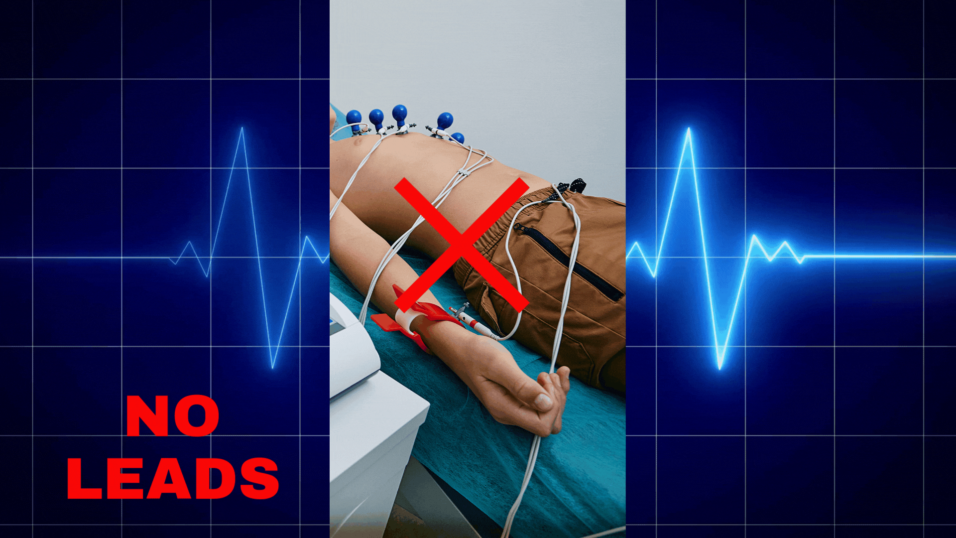 Leadless 12-Lead ECG Visualization